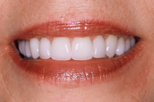cosmetic dentist Grand Rapids MI and Rockford MI