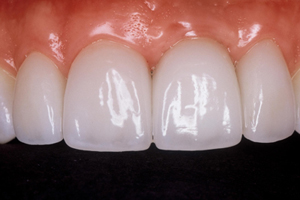 aesthetic dentistry with a Comstock Park dentist Grand Rapids MI