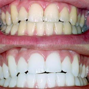 cosmetic dentistry with a Rockford dentist Grand Rapids MI