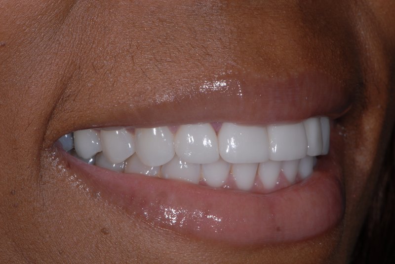 Patient has increased confidence thanks to the cosmetic dentists at Eric Hull DDS Aesthetic & General Dentistry.