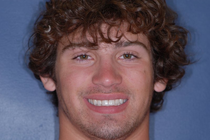 Patient showing off his brand new porcelain dental veneers near Grand Rapids.