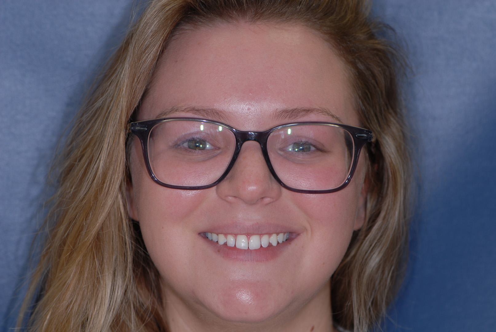 Smiling Grand Rapids patient before her aesthetic dentistry treatment.