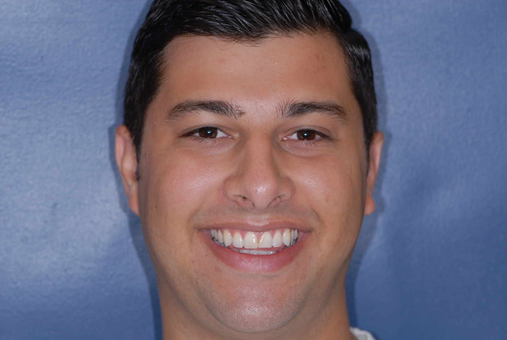 Smiling Grand Rapids patient before his cosmetic dentistry treatment.