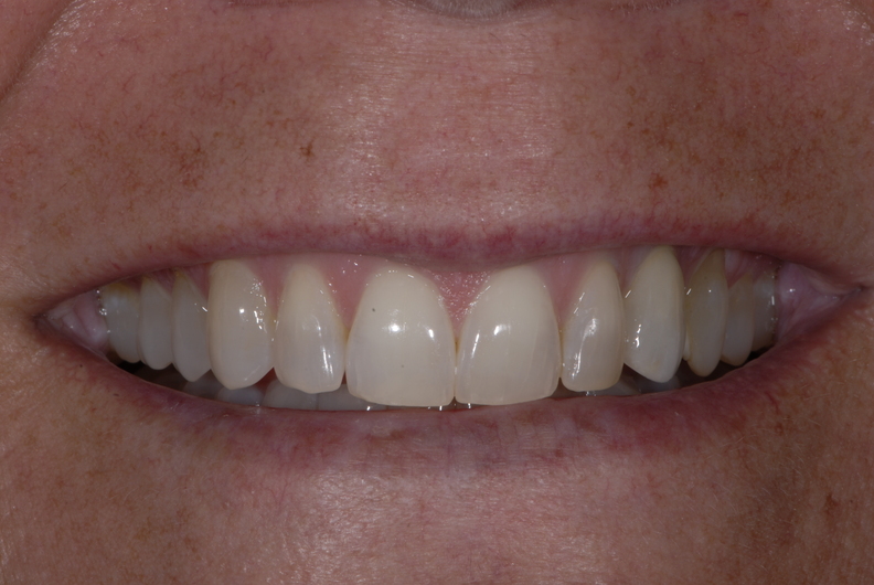 Patient has increased confidence thanks to the cosmetic dentists at Eric Hull DDS Aesthetic & General Dentistry.