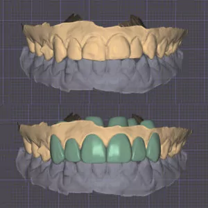 Alexis Injection Molding case digital impressions