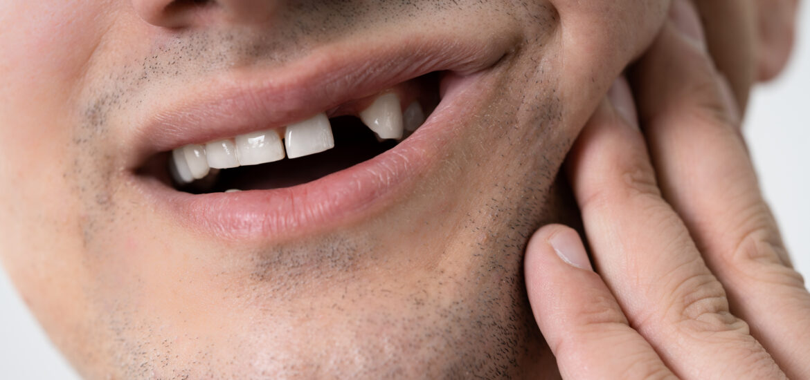 Close-up Of A Man with a missing tooth problem