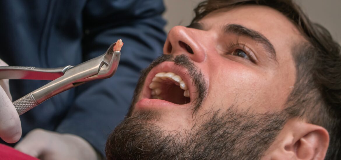 young man having a tooth pulled in Comstock Park