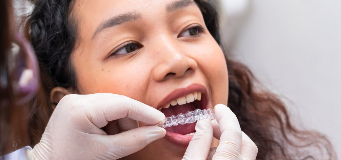 dentist fitting clear aligners with a young female patient
